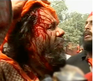  Firing in delhi| firing before parlament| firing at guru dwara| gurudwara prabandhak comitee| attack with talwars| parlament street| police control| police action